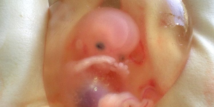 Foetus (Representative image)