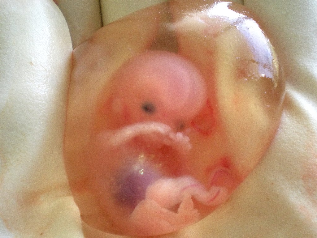 Foetus (Representative image)