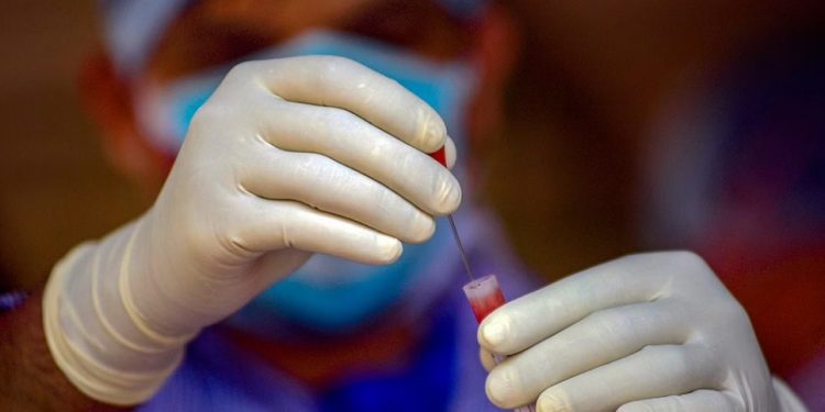 ICMR has trained 15 Virus Research and Diagnostic Laboratories across the country to conduct diagnostic test for Monkeypox. (Representative Image/PTI)