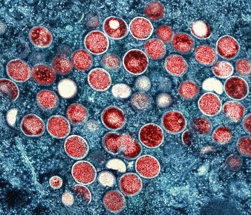Monkeypox virus. (Creative Commons)