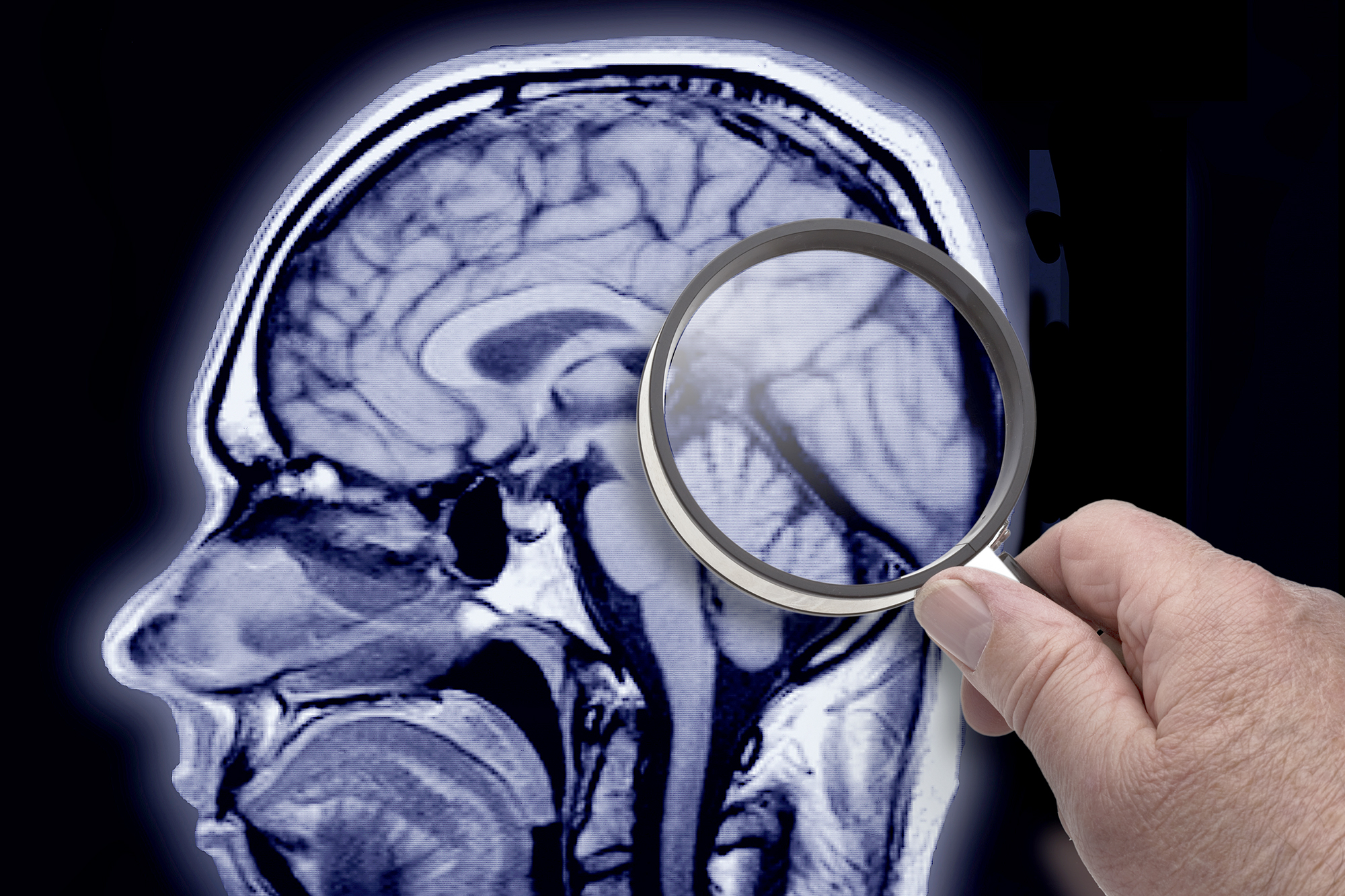 Alzheimer's can be prevented if you start exercising your brain nerves much earlier say docs