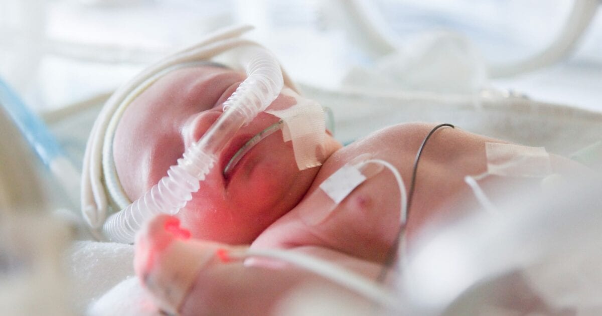 Representational pic of a baby in Neonatal Intensive Care Unit (N-ICU)