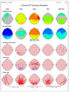 Brain mapping waves