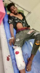 One of the accused in the Coimbatore daylight murder case who was shot and injured by the police as he tried to escape.