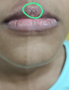 lip balm