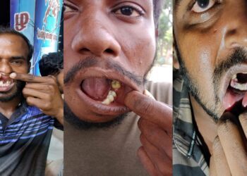 Victims show gaps in their teeth, the result of custodial torture. (Supplied)