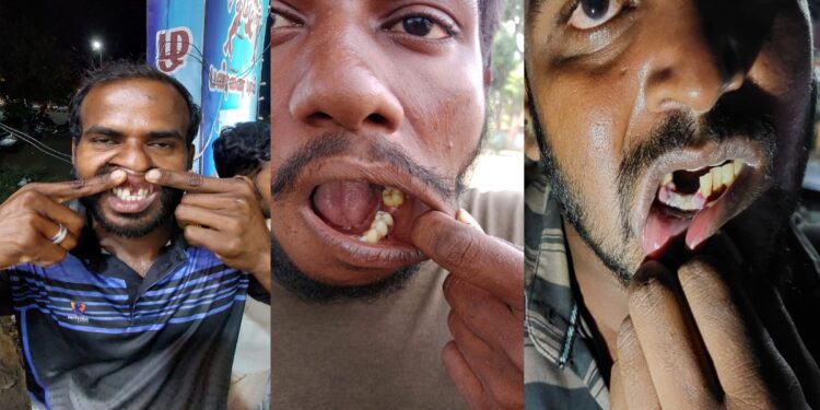 Victims show gaps in their teeth, the result of custodial torture. (Supplied)