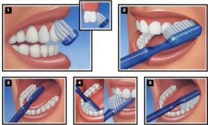Oral hygiene: Images showing the right way to brush from the All India Dental Students and Dental Surgeons Association (AIDSA). (Supplied)