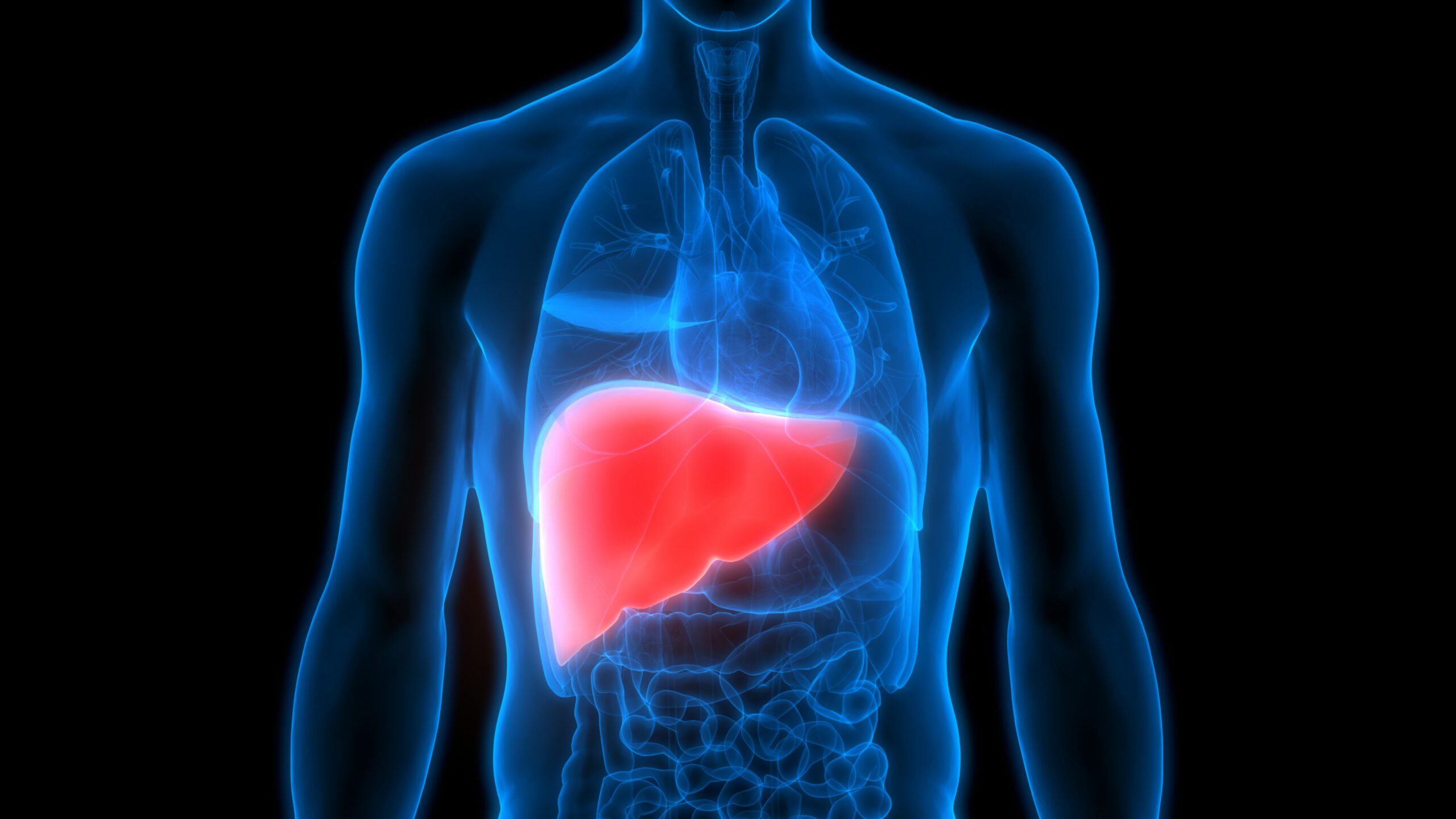 Fatty liver is the fat deposition in the normal liver. (Wikimedia Commons)
