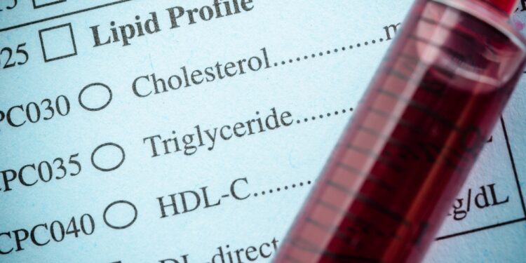 Do you know how to read your lipid profile report? Why it is important test to keep a check on your heart health