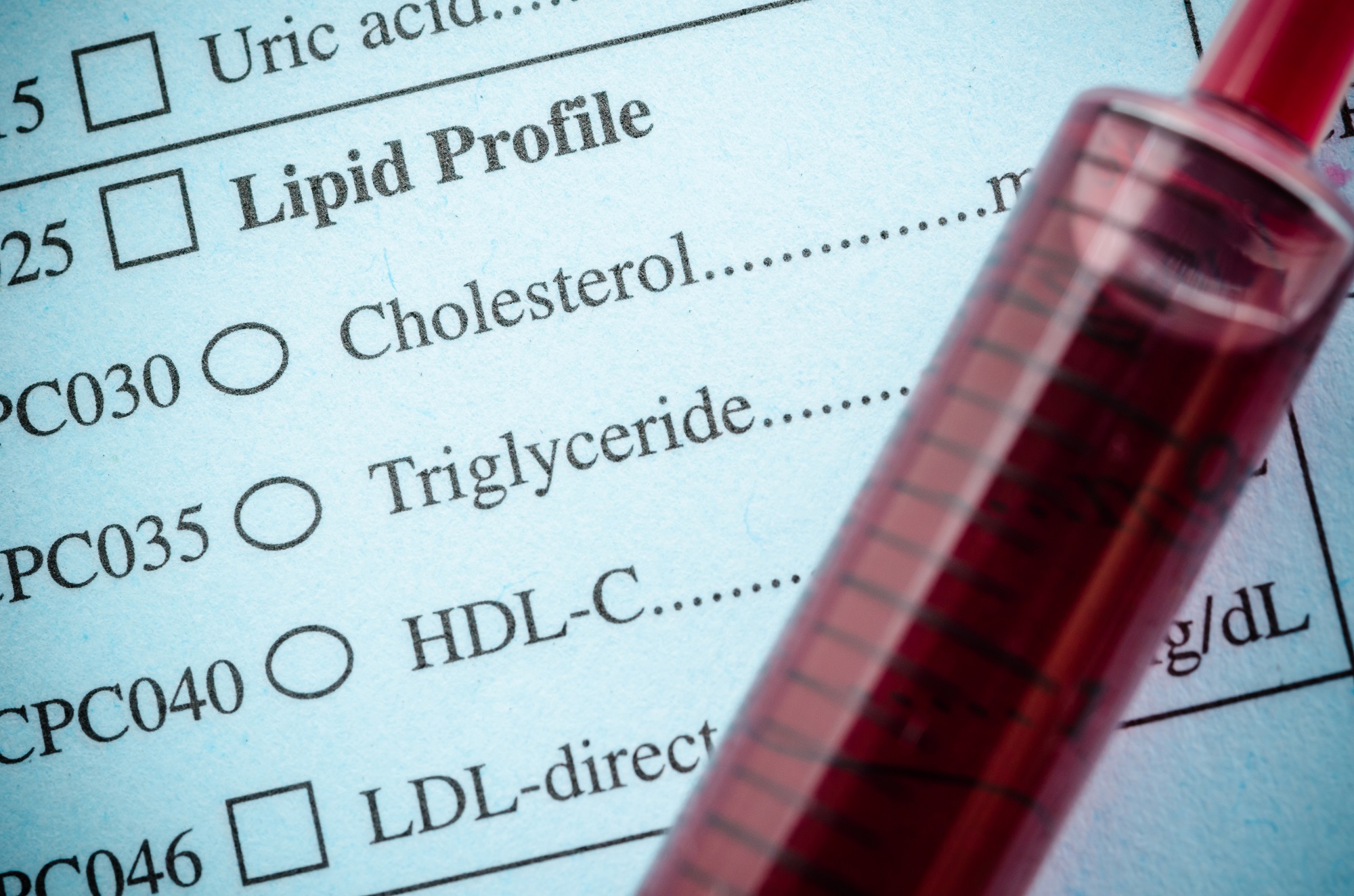 Do you know how to read your lipid profile report? Why it is important test to keep a check on your heart health
