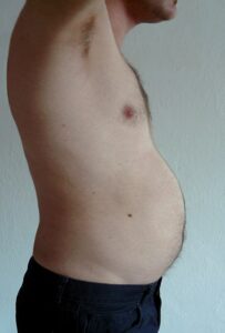 Abdominal obesity has the highest incidence in Kerala and Tamil Nadu in South India. (Wikimedia Commons)