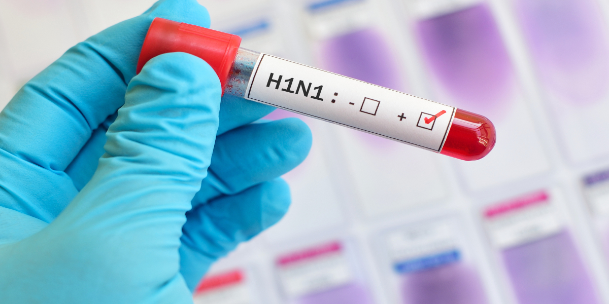 First confirmed case of H1N1 virus in Malappuram district raises concerns amidst rising fever cases. (Commons)