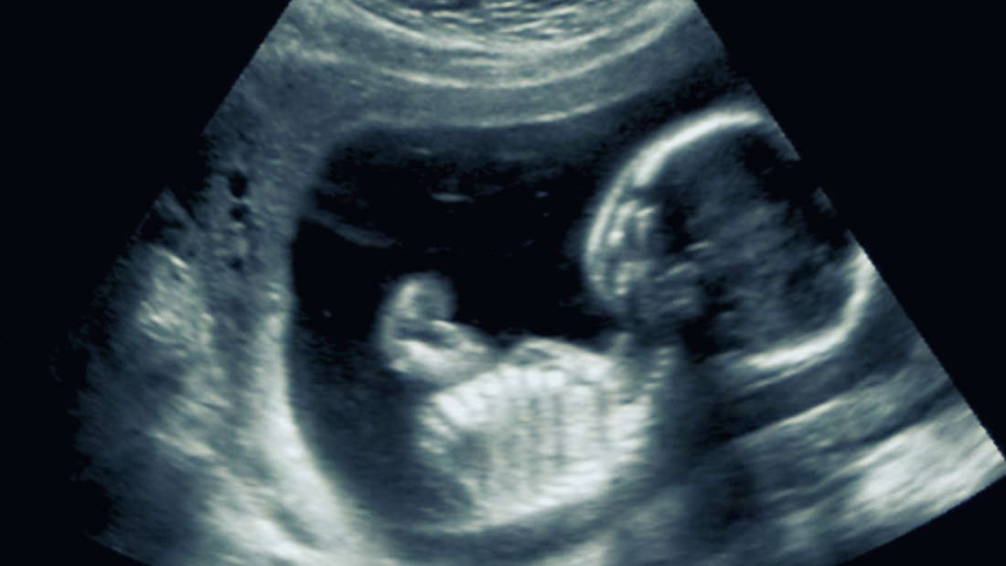 A TIFFA scan is a key scan that is used to assess the health of the baby and identify any concerns. (Wikimedia Commons)
