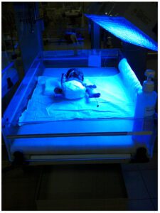 Phototherapy is treatment with a special type of light. (Wikimedia Commons)