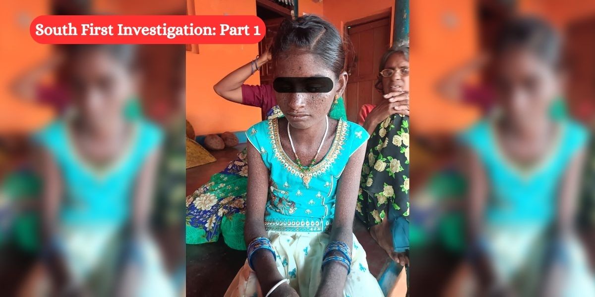 Afflicted with rare genetic condition, children in three Karnataka villages await death in darkness