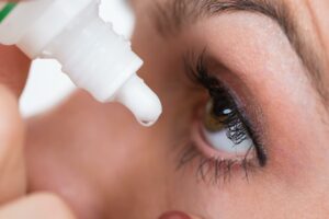 Representation pic of woman using eye drops for Dry Eye condition.