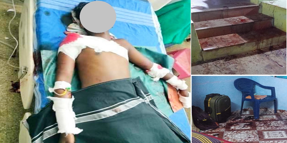 Armed with sickles, the gang hacked Chinnadurai, causing injury to his head, hand, and abdomen. Further, the gang attacked his 14-year-old sister too. (Supplied)