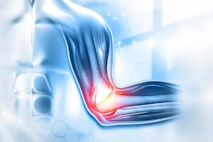 Tendon injuries are the common type of injuries