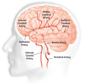 Various arteries to the brain, which supply blood to specific areas of the brain. (American Stroke Association)