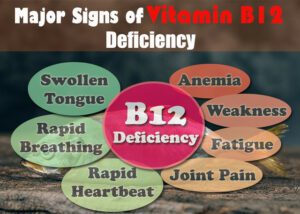 Signs of Vitamin B12 deficiency. (Creative Commons)