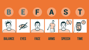 BEFAST is the commonly used stroke acronym to help the public easily remember the signs of a stroke. (Ohio State Health)