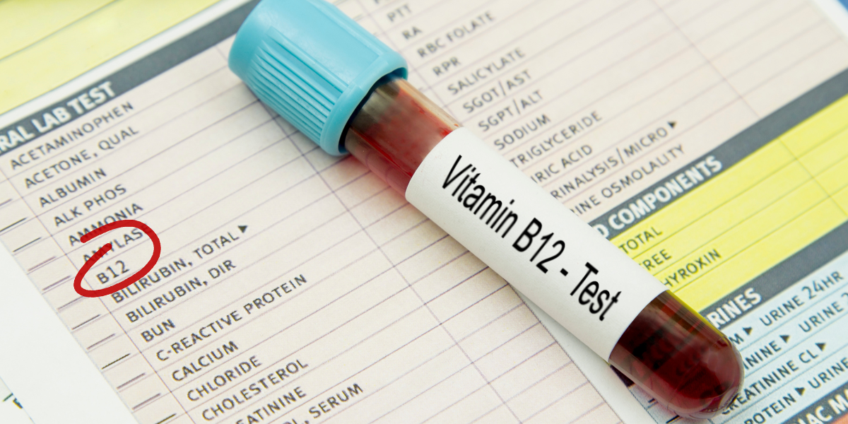 Vitamin B12 deficiency can have symptoms ranging from anaemia to discoloration to tingling of extremities, and more. (Commons)