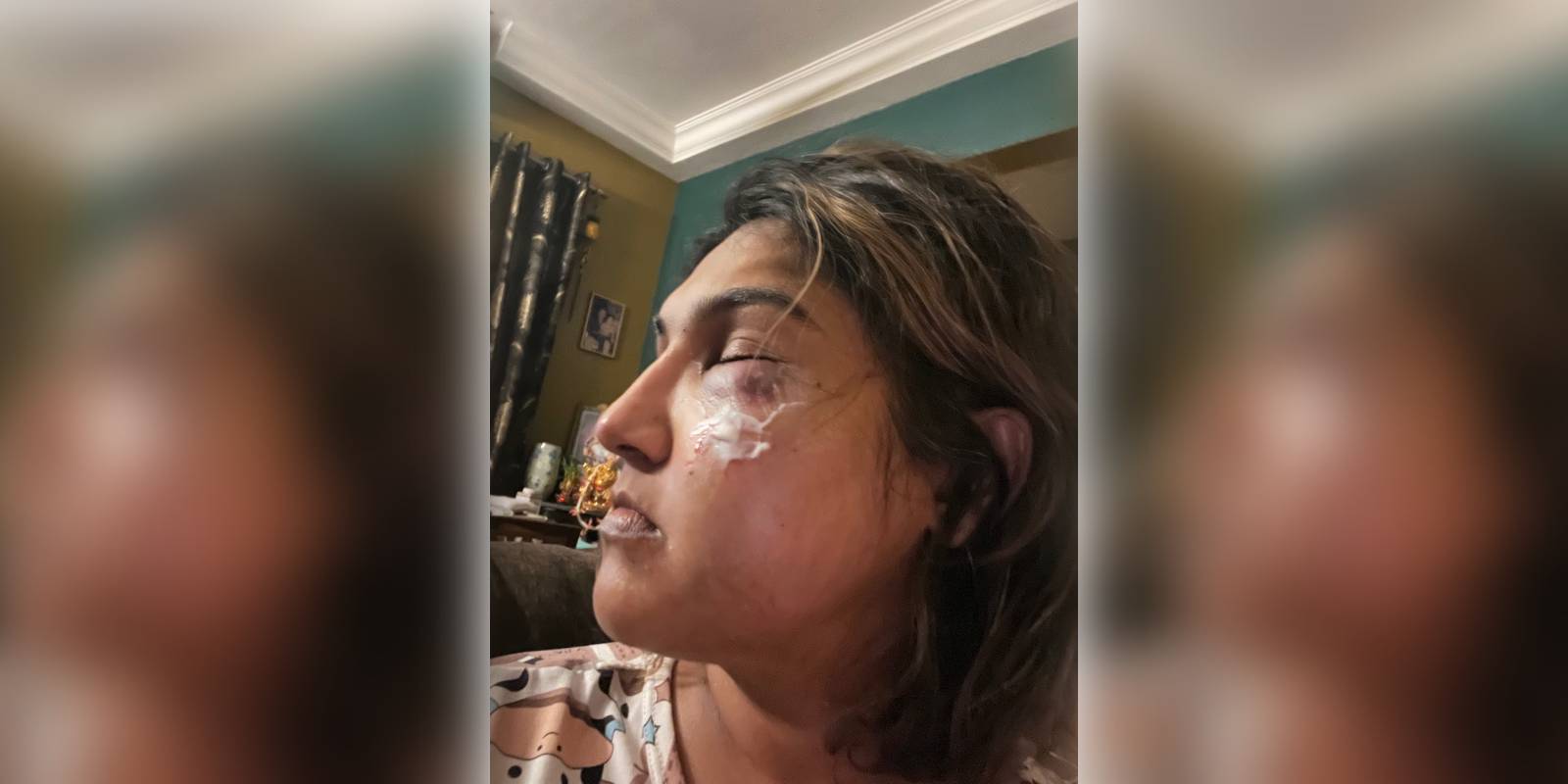 Vanitha Vijayakumar attacked