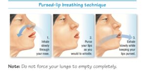 Pursed-lip breathing techniques for COPD patients. (Supplied)