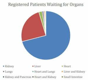 Patients waiting for organs in Karnataka. (Supplied)