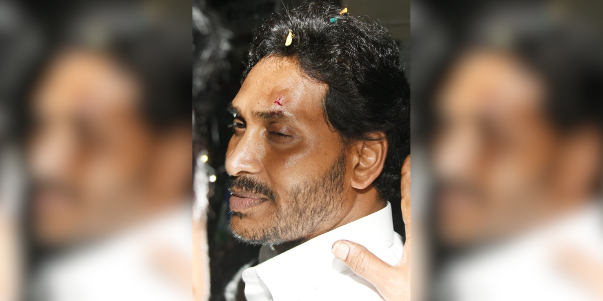 CM Jagan Mohan Reddy with an injury above his left eyebrow. (Sourced)