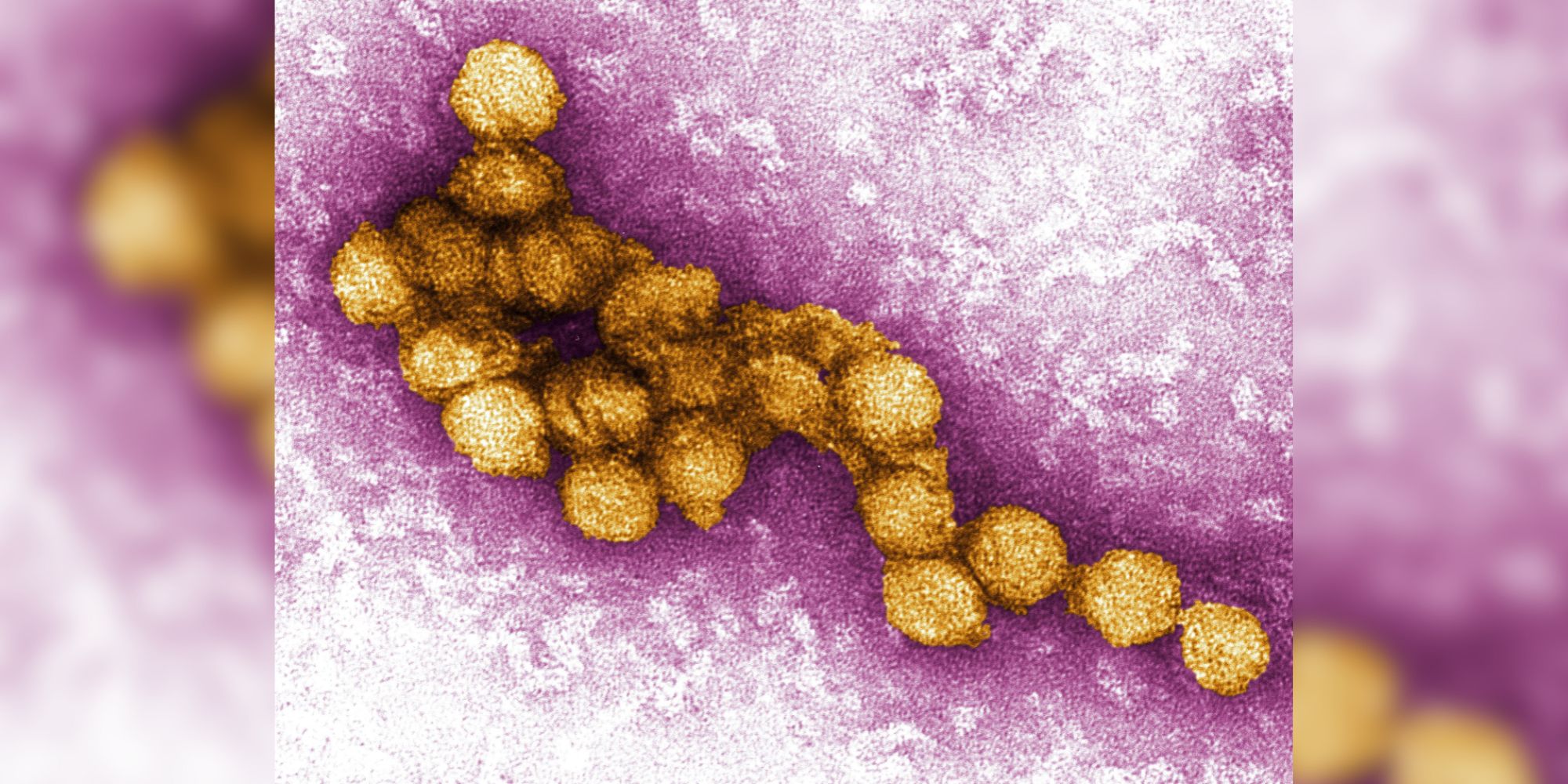 A micrograph of the West Nile Virus, appearing in yellow.